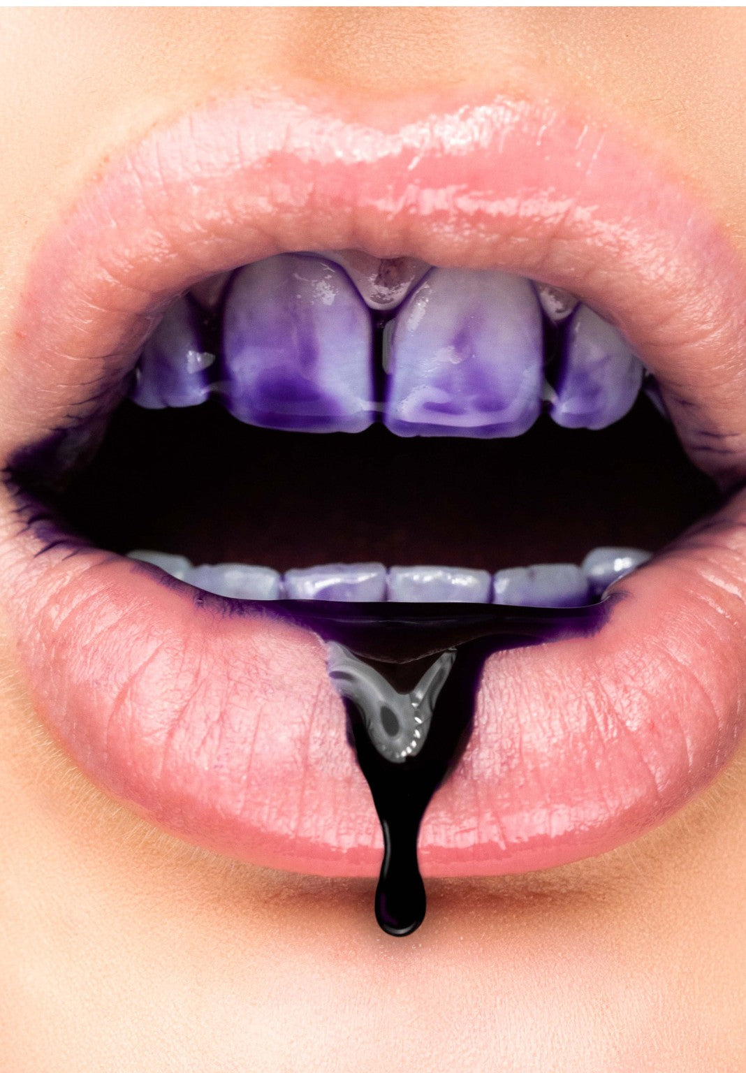 Maximum Whitening Bundle