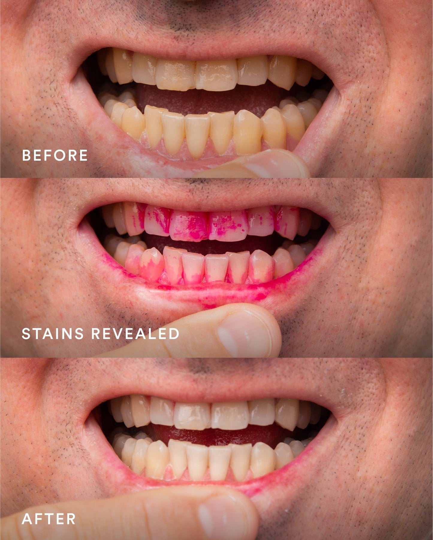 iD Stain Eraser